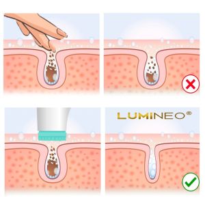 ЧЕТКА ЗА ЛИЦЕ 3 В 1 - LUMINEO HOME SPA + ГЕЛ ЗА АКНЕИЧНА КОЖА 100 мл
