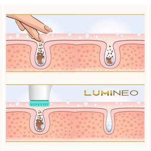 ЧЕТКА ЗА ЛИЦЕ 4 В 1 - LUMINEO PRO HOME SPA + ГЕЛ ЗА ВСИЧКИ ТИПОВЕ КОЖА 100 мл - ТЮРКОАЗ
